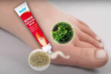 bunion pain relief cream