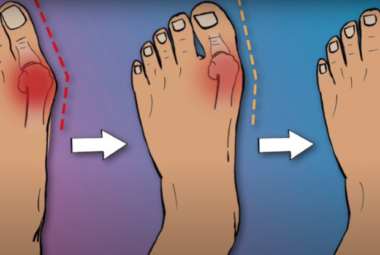 gout pain relief cream