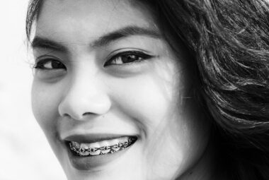 Braces Pain Relief