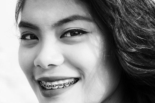 Braces Pain Relief