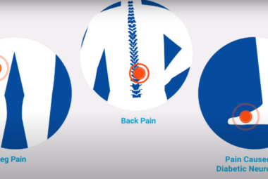 HFX Pain Relief
