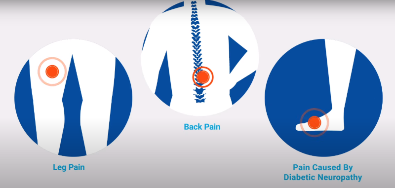 HFX Pain Relief